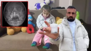Rize’de şiddetli burun kanaması ve akıntı şikayetleriyle ailesi tarafından götürüldüğü