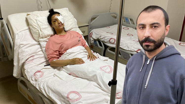 'Ağabey' demeyen yengesini 37 yerinden bıçaklayıp kör etti