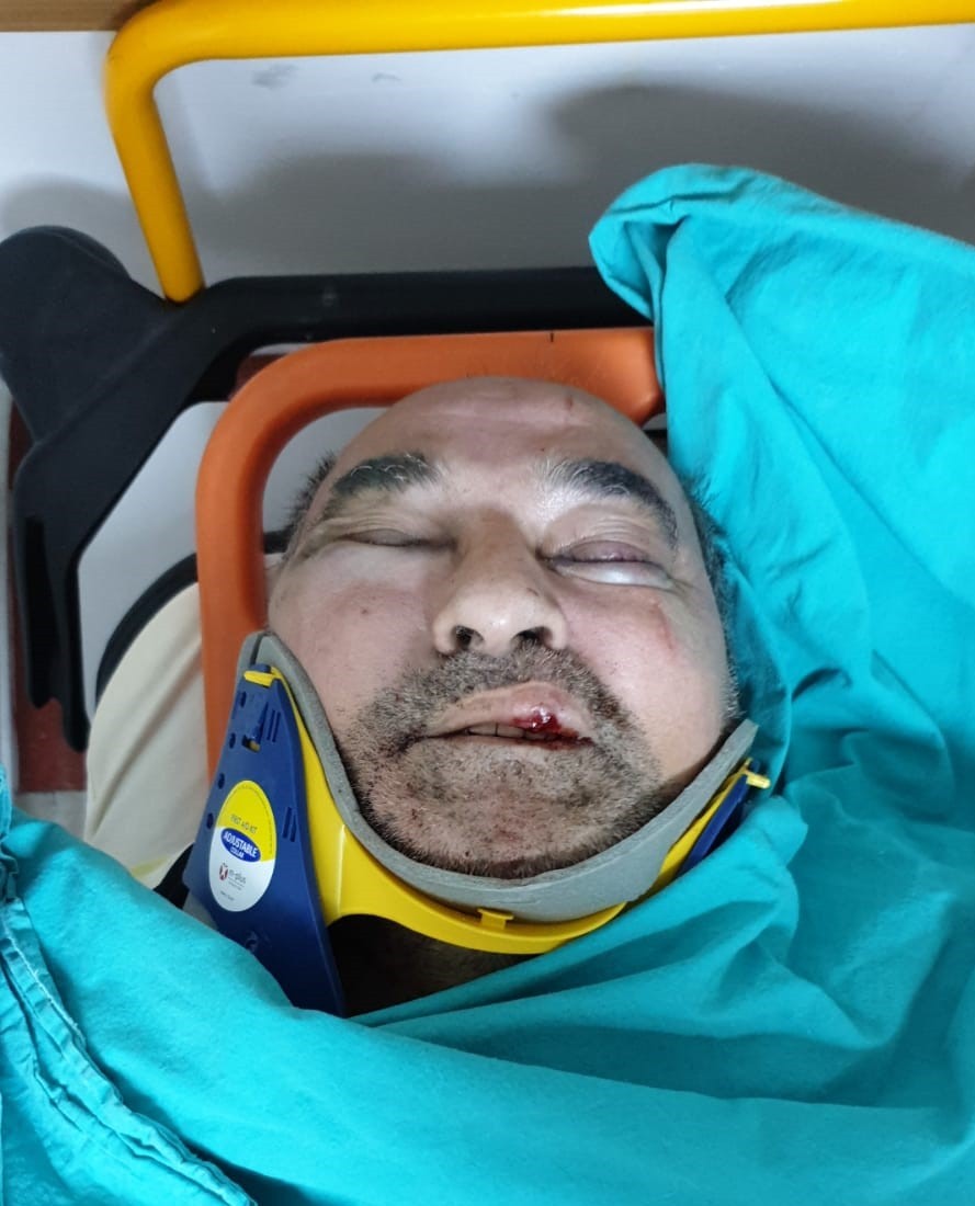 Yazar Ergün Poyraz saldırısında: 6 gözaltı
