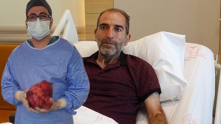 Halsizlik şikayetiyle gitti, karnından 20 santimlik kitle çıkarıldı