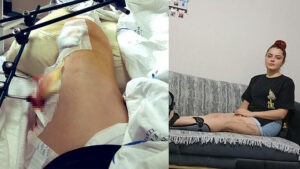Manisa’da, ayrılmak istediği sevgilisi Adem Yılmaz’ın (40) diz kapağından tabancayla