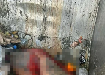 Sokak ortasında insan derisi bulundu