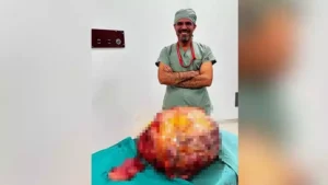 Trabzon’da karın ağrısı ve yürüme güçlüğü şikayetiyle hastaneye giden H.O.’nun (64) karnından,