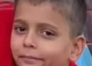 Üzerine döktüğü kolonya ile yanan 11 yaşındaki Mert, öldü
