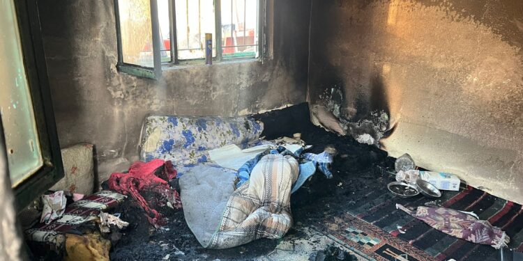 Acarlar’da yanan evde hayatını kaybetti