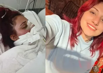 Burun estetiği ameliyatı genç kızın sonu oldu