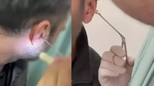 Kayseri’de polisin şüphe üzerine durdurduğu ve hastanede beden muayenesi yapılan