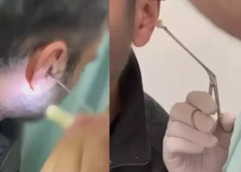 Kulağına gizlediği uyuşturucuyla yakalandı