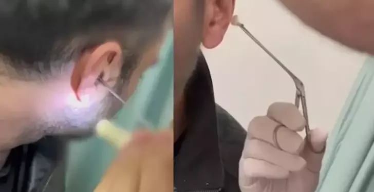 Kulağına gizlediği uyuşturucuyla yakalandı